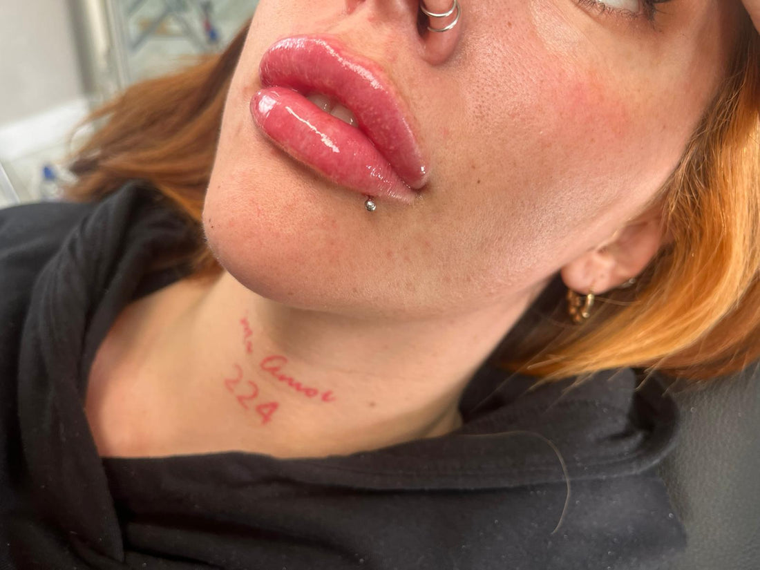 The first 24 hours after lip filler